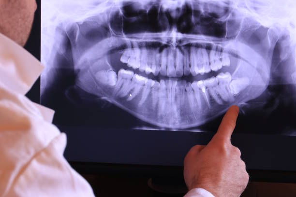 Best Broken Tooth Emergency  in Beachwood, NJ