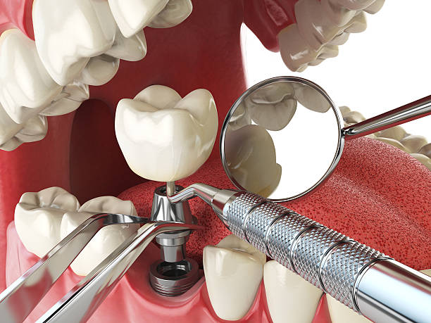 Best Root Canal Emergency Dentist  in Beachwood, NJ