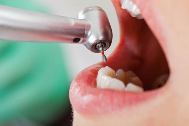 Best Tooth Infection Emergency Dentist  in Beachwood, NJ